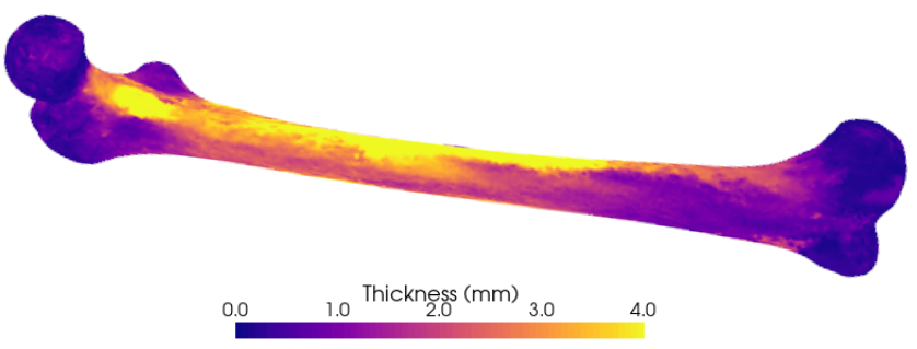 Cortical bone mapping